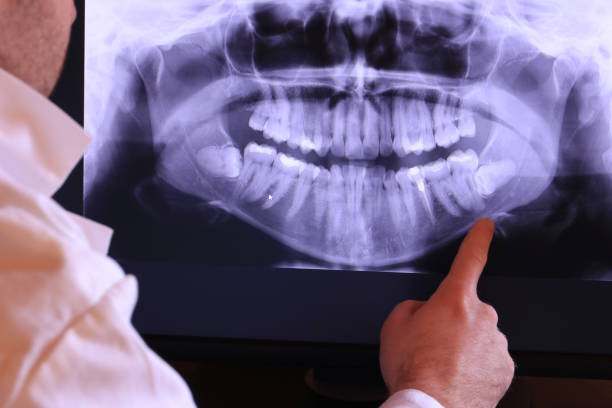 Best Emergency Denture Repair in Springville, VA